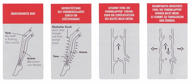 Elbeo Stützfunktion Schaubild